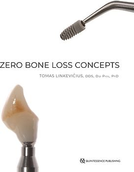 Zero Bone Loss Concepts