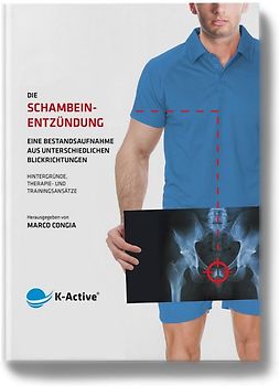 Die Schambeinentzündung