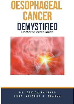 Oesophageal Cancer Demystified Doctors Secret Guide