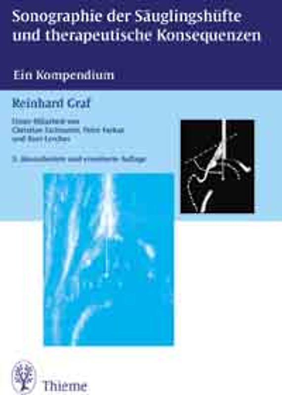 Sonographie der Säuglingshüfte und therapeutische Konsequenzen (Buch + CD-ROM)