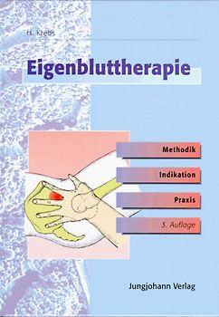 Eigenbluttherapie. Methodik, Indikation und Praxis