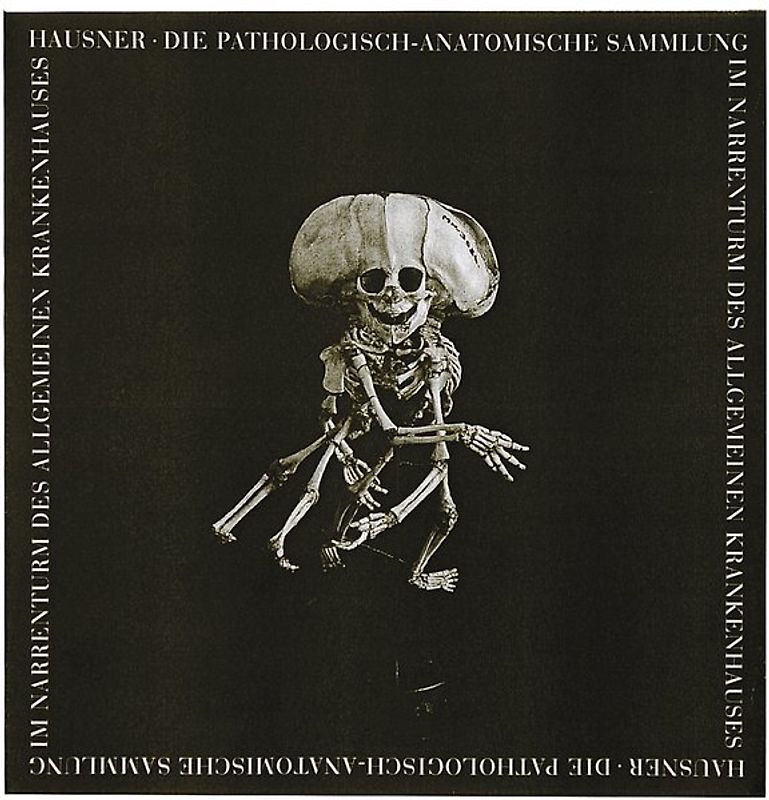 Die Pathologisch-Anatomische Sammlung im Narrenturm des Alten Allgemeinen Krankenhauses