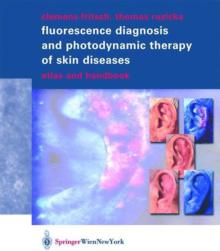 Fluorescence Diagnosis and Photodynamic Therapy of Skin Diseases