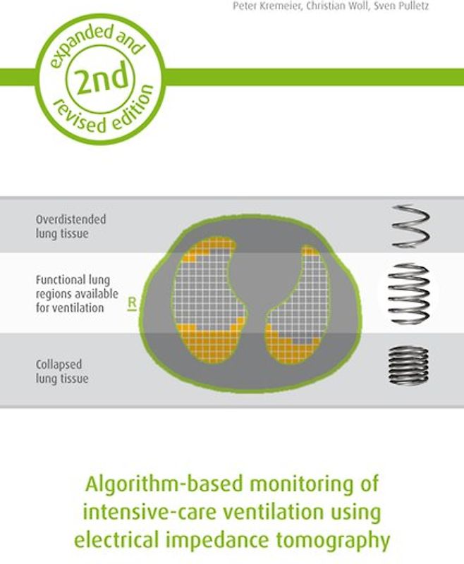 Algorithm-based monitoring of intensive-care ventilation using electrical impedance tomography
