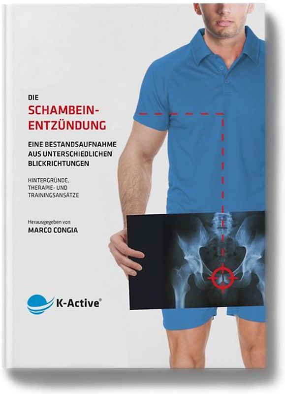 Die Schambeinentzündung