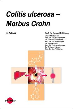 Colitis ulcerosa - Morbus Crohn