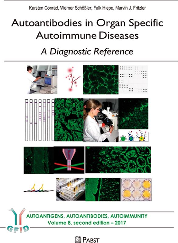 Autoantibodies in Organ Specific Autoimmune Diseases – A Diagnostic Reference