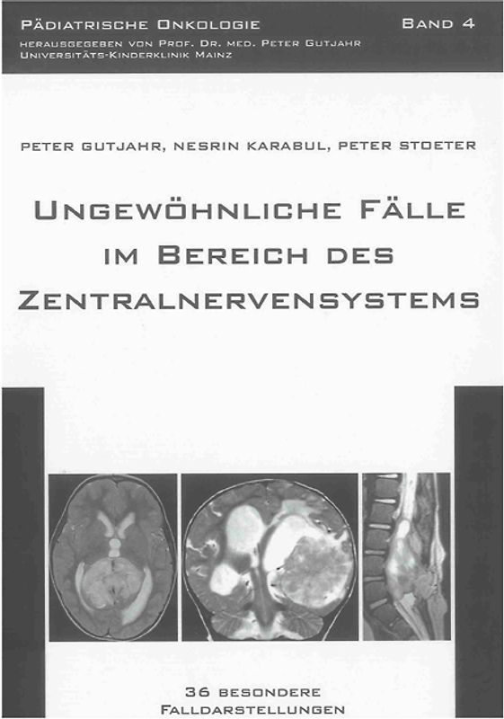 Ungewöhnliche Fälle im Bereich des Zentralnervensystems