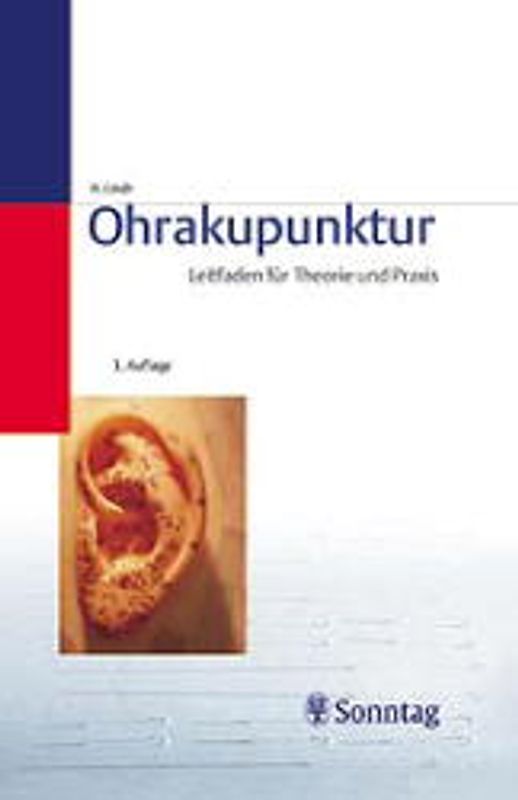Ohrakupunktur