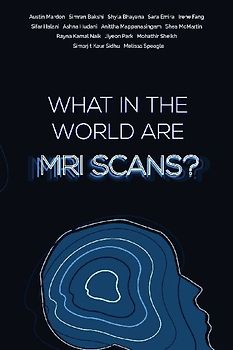 What in the world are MRI Scans?
