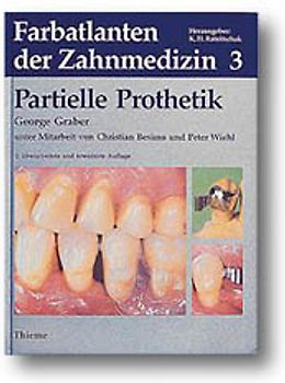 Partielle Prothetik