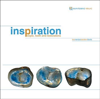 Inspiration: People, Teeth, and Restorations - Luiz Narciso Baratieri [Hardcover]
