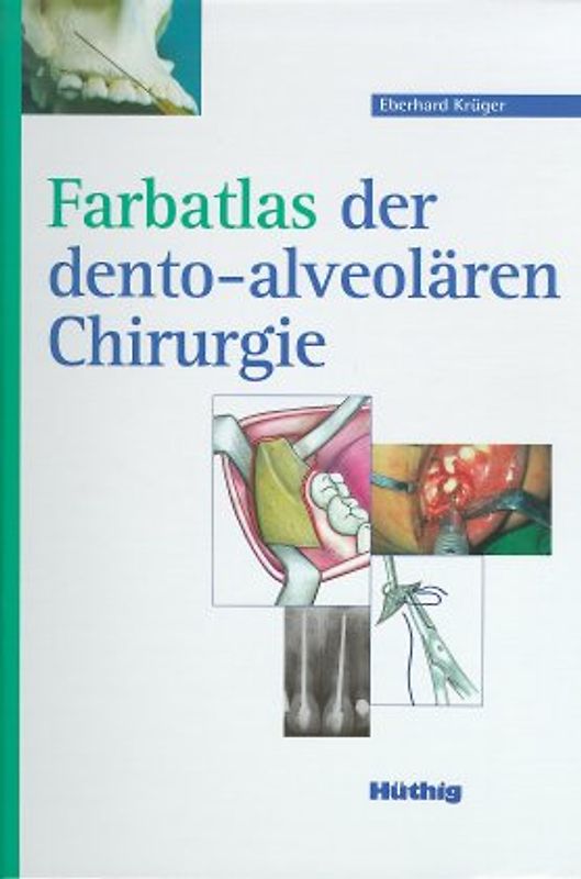 Farbatlas der dento-alveolären Chirurgie