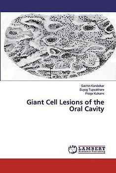 Giant Cell Lesions of the Oral Cavity