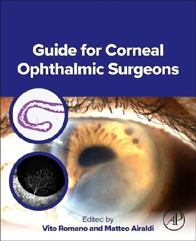 Guide for Corneal Ophthalmic Surgeons