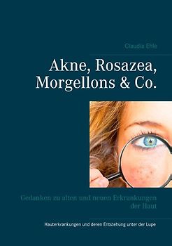 Akne, Rosazea, Morgellons & Co.. Gedanken zu alten und neuen Erkrankungen der Haut