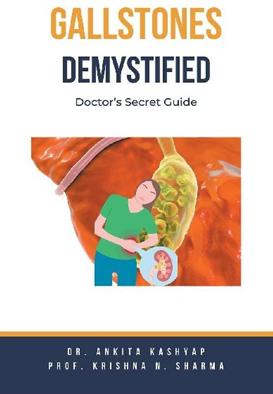 Gallstones Demystified