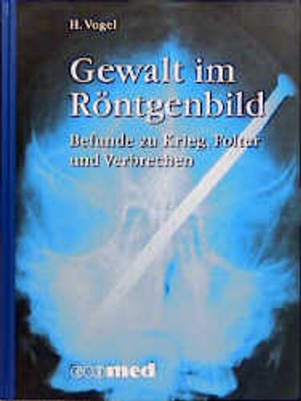 Gewalt im Röntgenbild