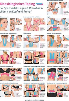 Poster Kinesiologisches Taping (3 Poster im Set)