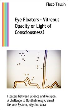 Eye Floaters - Vitreous Opacity or Light of Consciousness?