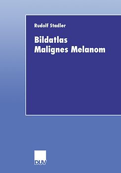 Bildatlas Malignes Melanom
