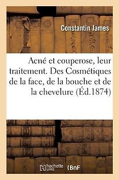 Acné et couperose, leur traitement par une nouvelle méthode