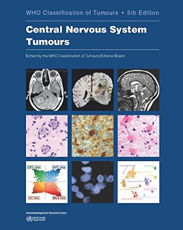 Central Nervous System Tumours: Who Classification of Tumours (WHO Classification of Tumours, 6)