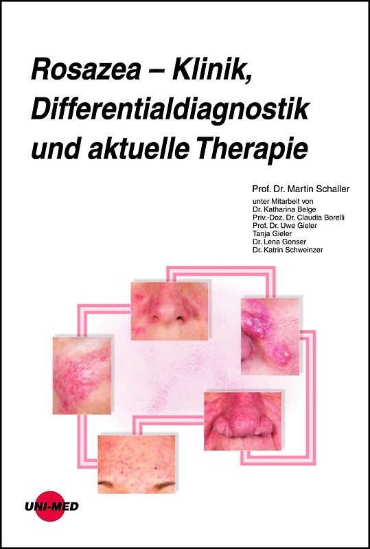 Rosazea – Klinik, Differentialdiagnostik und aktuelle Therapie