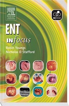 Elsevier Churchill Livingstone: ENT in Focus - Robin Youngs