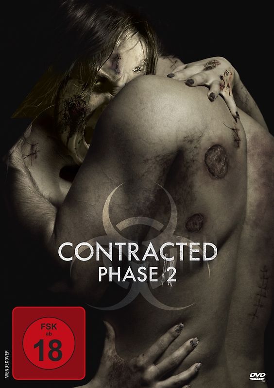 Contracted-Phase 2 DVD