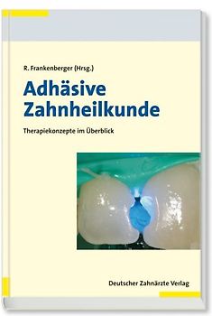 Adhäsive Zahnheilkunde