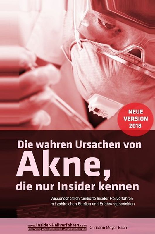Die wahren Ursachen von Akne, die nur Insider kennen