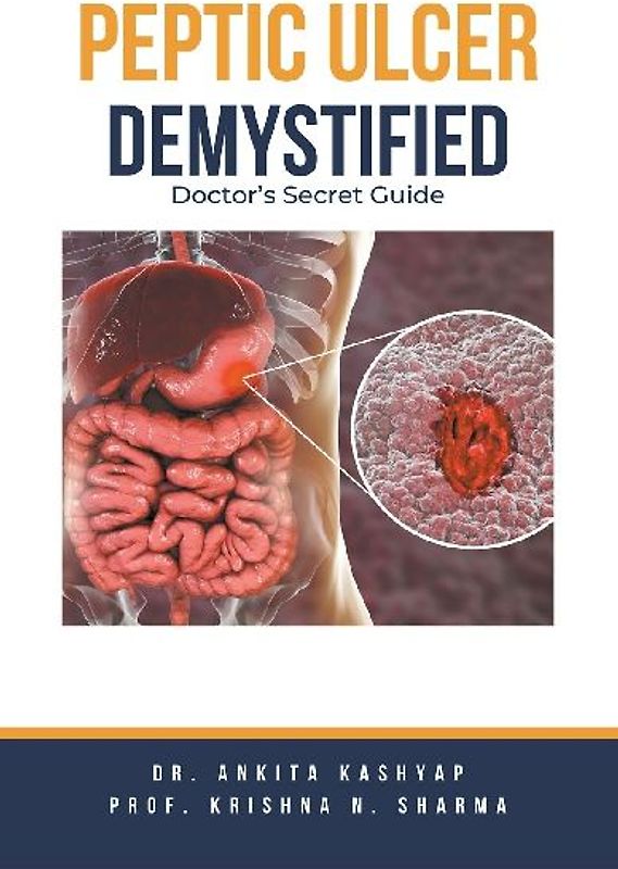 Peptic Ulcer Demystified