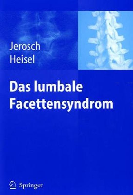 Das Facetten-Syndrom. Ursachen - Diagnostik - Therapie - Prophylaxe