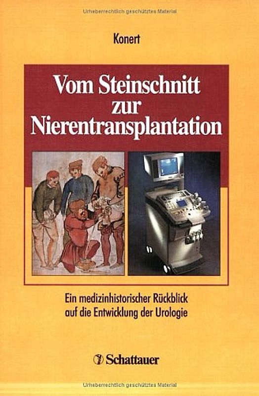 Vom Steinschnitt zur Nierentransplantation