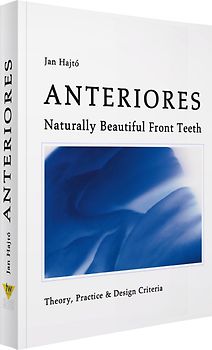 Anteriores - Naturally Beautiful Front Teeth