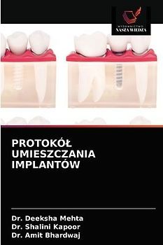 PROTOKÓ¿ UMIESZCZANIA IMPLANTÓW