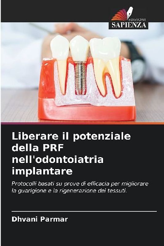 Liberare il potenziale della PRF nell'odontoiatria implantare
