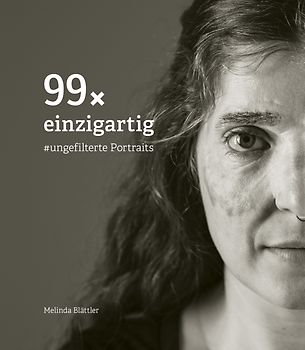 99× einzigartig