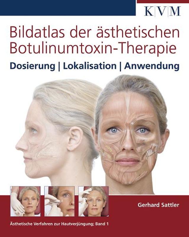 Bildatlas der ästhetischen Botulinumtoxin-Therapie