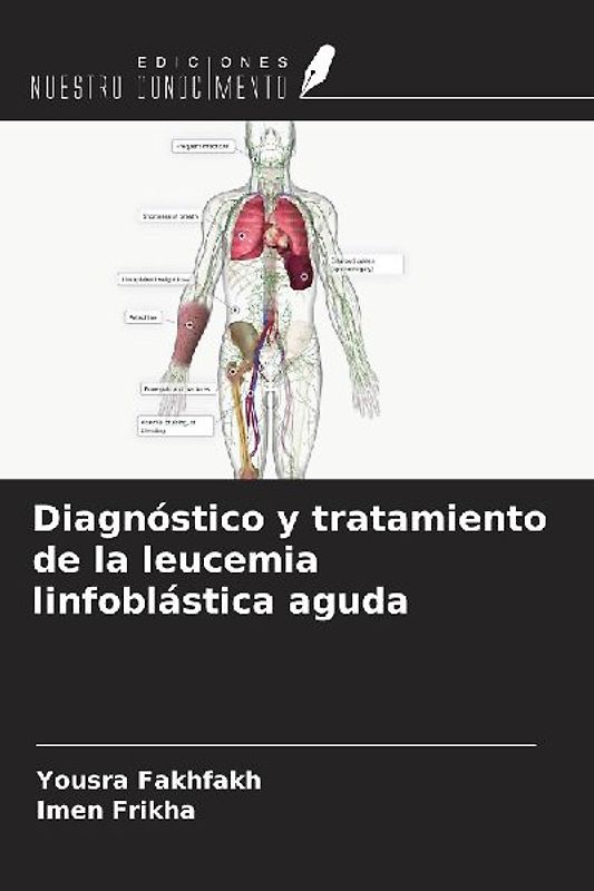 Diagnóstico y tratamiento de la leucemia linfoblástica aguda