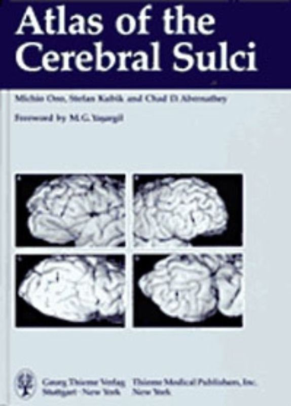 Atlas of the Cerebral Sulci
