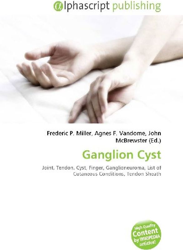 Ganglion Cyst