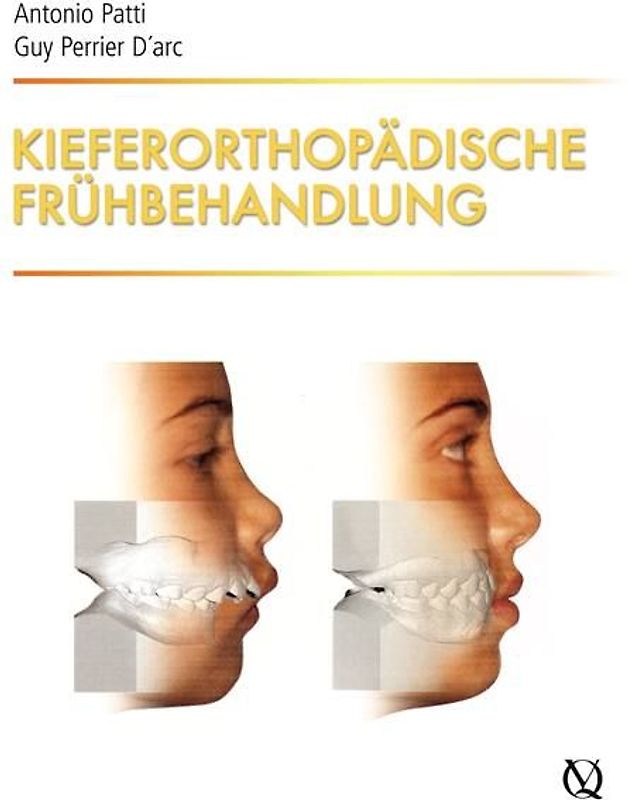Kieferorthopädische Frühbehandlung