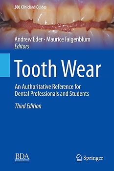 Tooth Wear
