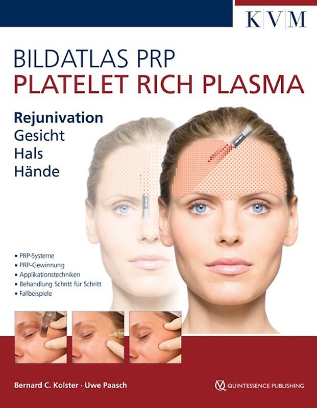 Bildatlas Kollageninduktion mit Platelet Rich Plasma (PRP)