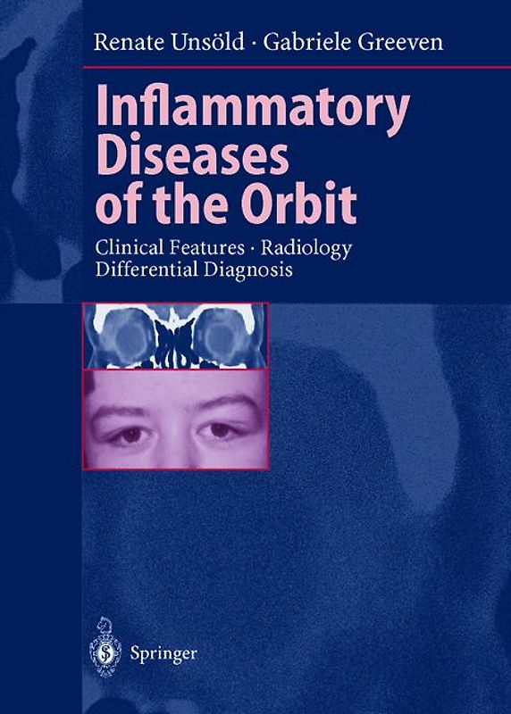Inflammatory Diseases of the Orbit