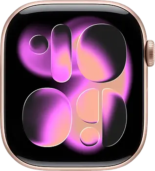 Apple Watch Series 11 46 mm Boîtier aluminium or rose [Wi-Fi]