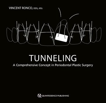 Tunneling