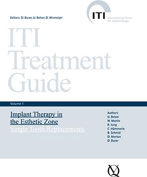 Implant Therapy in the Esthetic Zone